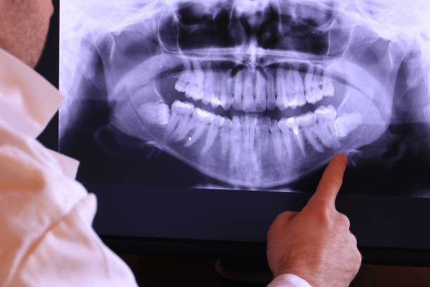 Best Emergency Tooth Extraction in Gardner, KS