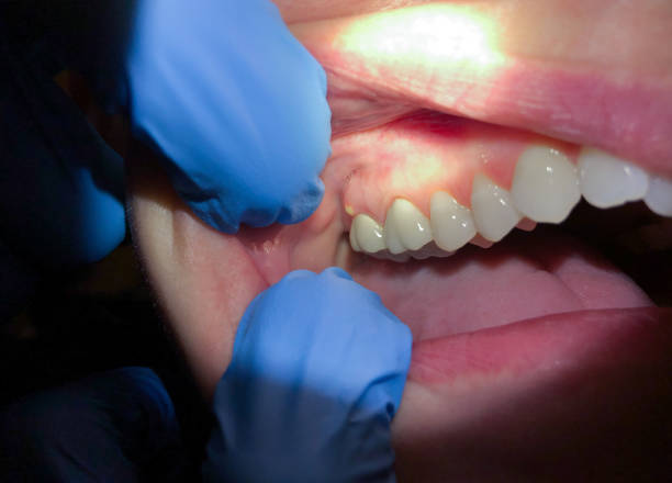 Best Emergency Gum Treatment in Gardner, KS
